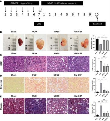 Myeloid-Derived Suppressor Cells Alleviate Renal Fibrosis Progression via Regulation of CCL5-CCR5 Axis